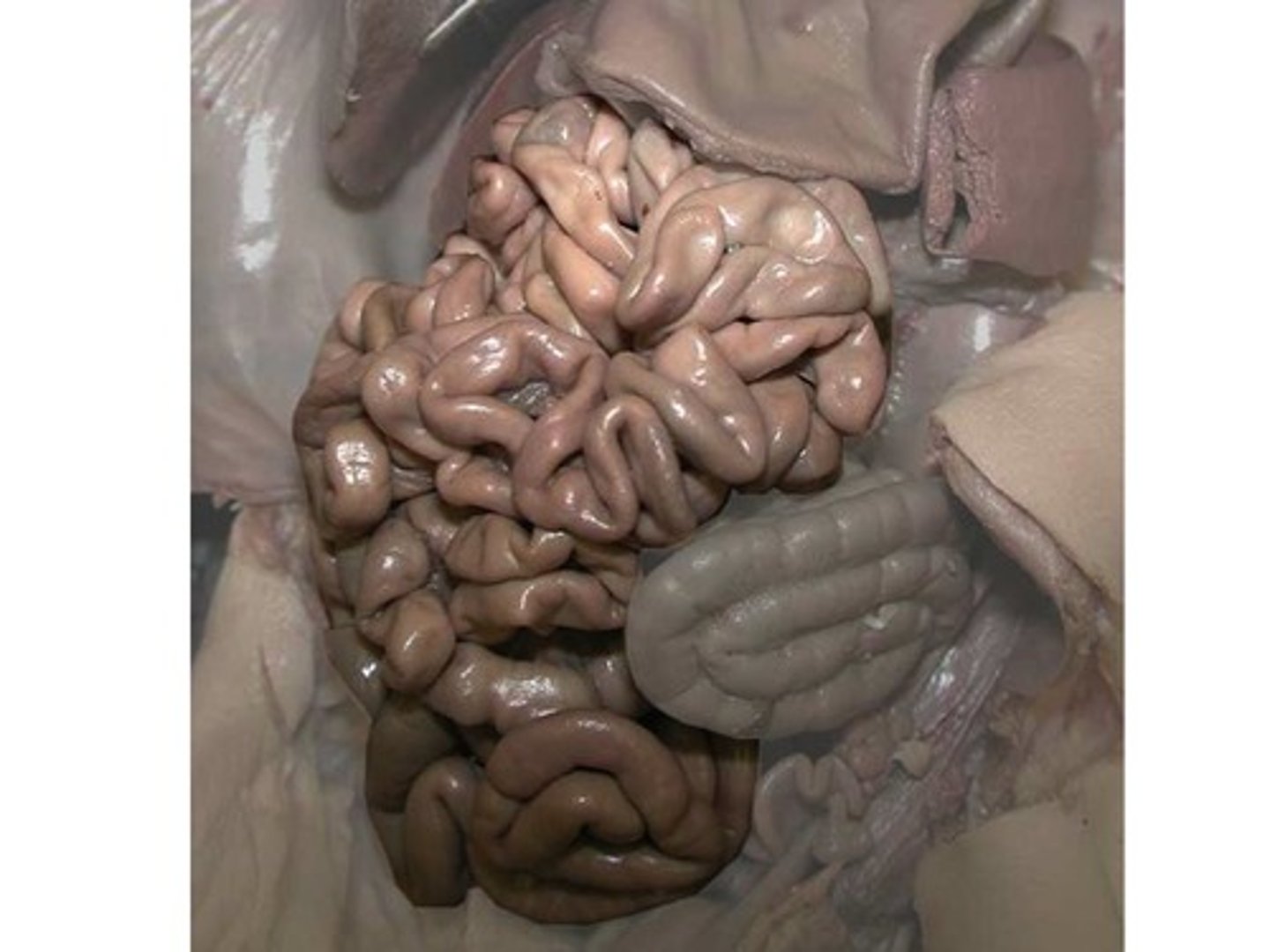 <p>Which organ is standing out in this photo?(background organs have been lightened)</p>