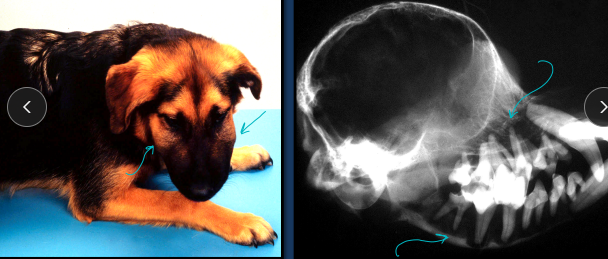 <p>Renal Secondary Hyperparathyroidism</p>