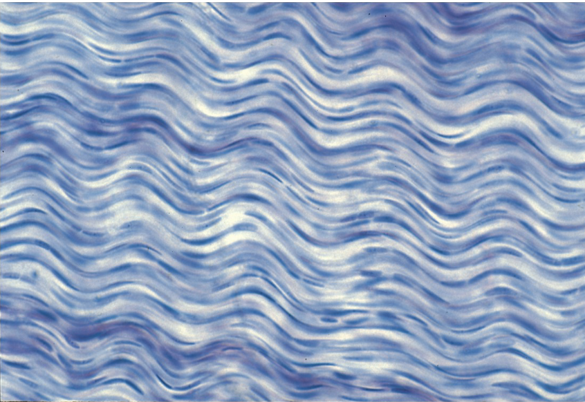 <p>Dense regular connective tissue</p>