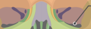 <p>What is the name of this bone in the skull the pointer?</p>
