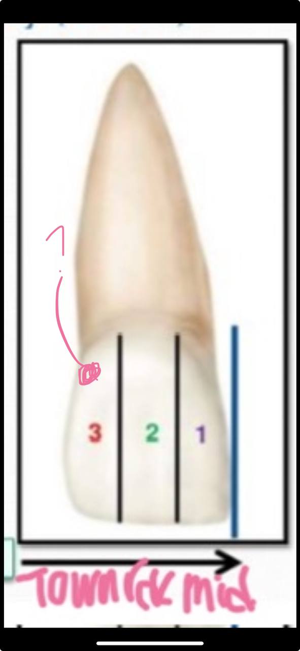 <p>what division is this in the thirds-mesio-distally (crown)</p>