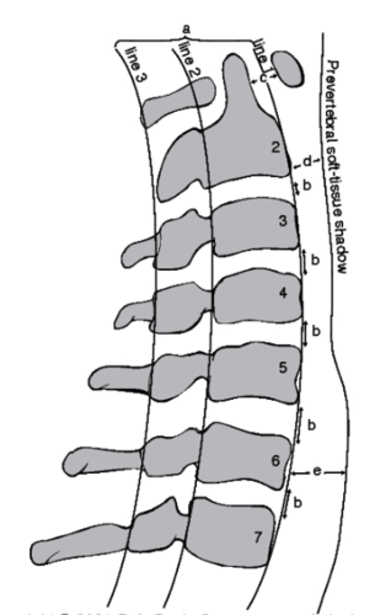 <p>which structure corresponds with the retrotracheal space?</p><p>a. Line 1</p><p>b. D</p><p>c. Line 3</p><p>d. E</p>