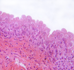 <p>Surface cells dome-shaped or squamous-like</p><p class="p1">depending on the organ stretch</p><p class="p1">-Stretches readily and permits distension of urinary</p><p class="p1">organ by contained urine</p><p class="p1">-urinary bladder, part of urethra</p>