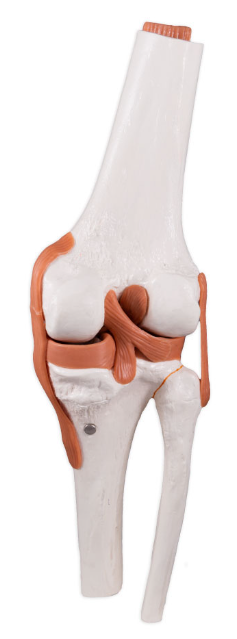 <p>What is the joint shown here?</p>