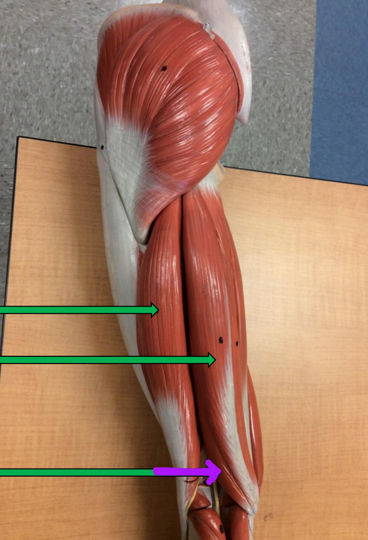 <p>Identify this muscle?</p>