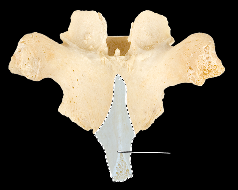 <p>What part of the vertebra is highlighted?</p><p>What type of vertebra is this (which region is this vertebra from)?</p><p>(Posterior view).</p>