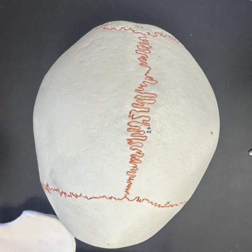 <p>What is the suture labeled 24?</p>