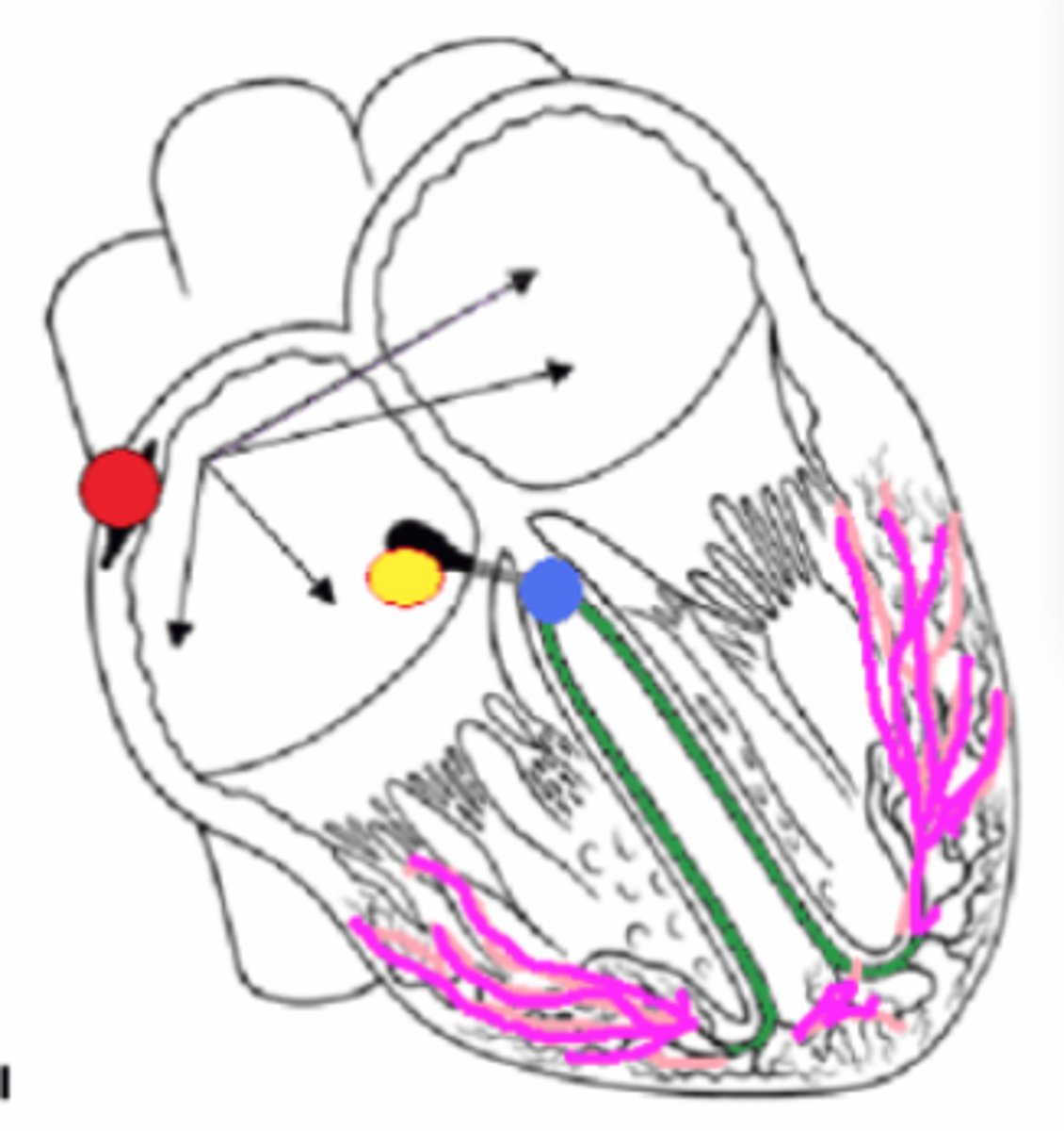 <p>Match the conduction pathway structure. (two letters used twice)</p><p>1) Right and Left Bundle Branches</p><p>2) AV Node</p><p>3) SA Node</p><p>4) AV Bundle or Bundle of HIS</p><p>5) Purkinje Fibers or Myofibers</p><p>6) Pacemaker</p><p>7) Atrial Nodal Pathway</p><p>8) Impulse hesitates here 0.1 seconds</p><p>a. Pink</p><p>b. Red</p><p>c. Yellow</p><p>d. Green</p><p>e. Black arrows</p><p>f. Blue</p>