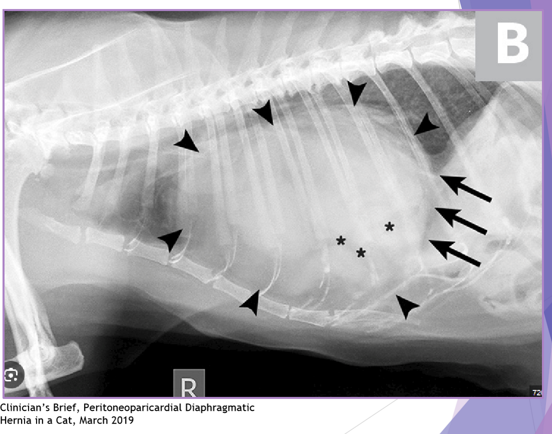 <ul><li><p>Peritoneopericardia d. hernia (PPDH) </p><ul><li><p>congenital common cavity between pericardium and peritoneal cavity </p></li><li><p>breeds: cocker spaniel, weimaraner, himalayan, DLH </p></li><li><p>clinical signs: </p><ul><li><p><strong>asymptomatic - most common </strong></p></li><li><p>respiratory dyspnea </p></li></ul></li><li><p>look for other congenital defects </p></li><li><p>diagnostic evaluation: thoracic radiographs </p><ul><li><p>enlarged, globoid cardiac silhouette </p></li><li><p>± gas opacity in the cardiac silhouette </p></li><li><p>pericardial effusion </p></li></ul></li></ul></li><li><p>surgical repair </p><ul><li><p>perform as early as possible (8-16 weeks of age) </p></li><li><p>abdominal exploratory </p></li><li><p>gently replace abdominal organs </p><ul><li><p>enlarge diaphragmatic defect if needed </p></li></ul></li><li><p>do not close the pericardial sac </p></li><li><p>close the diaphragmatic defect </p></li><li><p>remove air from thoracic cavity </p></li></ul></li><li><p>complications (traumatic and congenital) </p><ul><li><p>re-expansion pulmonary edema </p></li><li><p>abdominal compartment syndrome </p></li><li><p>acute respiratory distress </p></li></ul></li></ul><p></p>