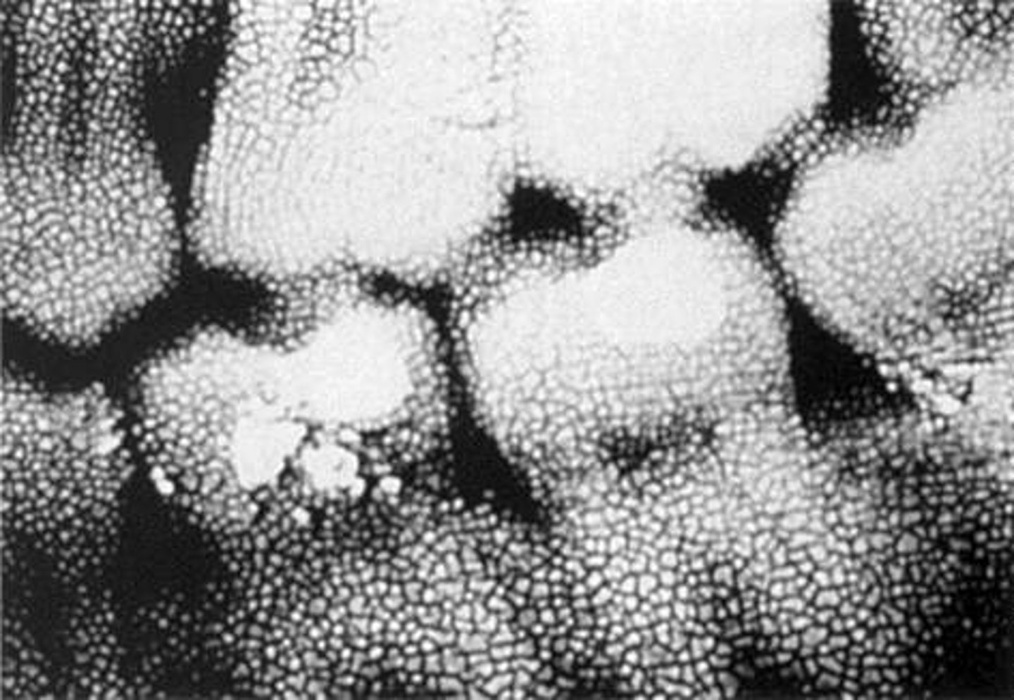 <p>When film is subjected to a sudden temperature change between the developer and the water. Appears as cracked film</p>