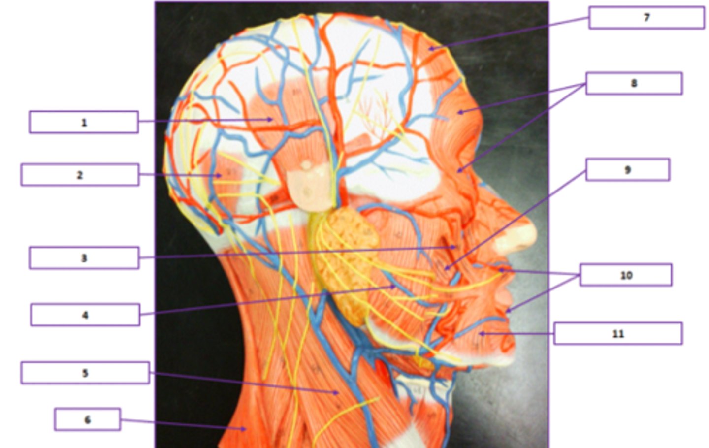 <p>Identify the muscle labeled 10.</p>