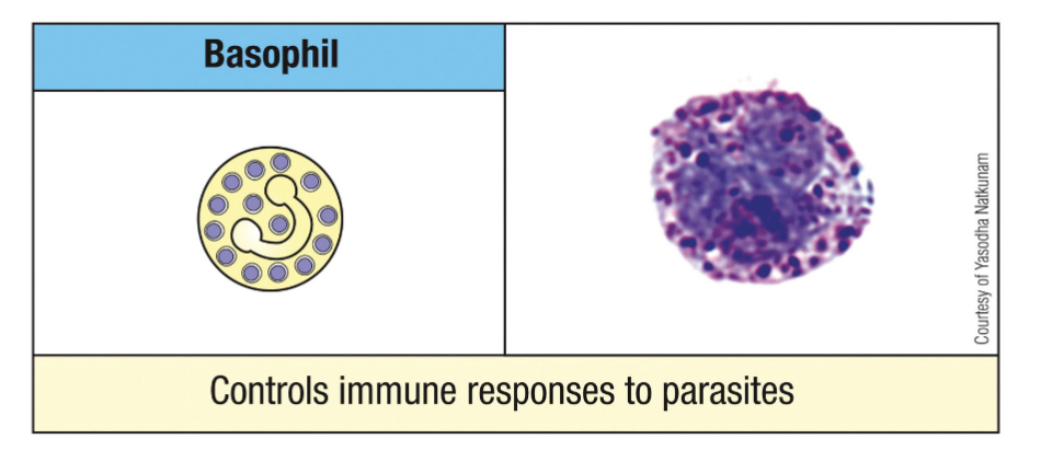 <p>super rare circulating cells</p><p>kills parasites by releasing granule contents </p><p><span>Important for killing extracellular parasites, including multi-cellular worms</span></p><p><span>Morphology: segmented nucleus (2 nuclear lobes), spherical purple granules (basophilic granules)</span></p><p>similar morphology to mast cells except basophils are much more stationary</p><p><span>Bind circulating antibody/antigen complexes (i.e., tagged pathogens) and release granule contents (i.e., histamines, leukotrienes, prostaglandins and cytokines)</span></p>