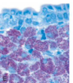 <p>mycobacteria are also positive with acid-fast stain</p>