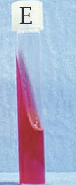 <p>Is this a positive or negative&nbsp;Kliger’s Iron Agar test?</p>