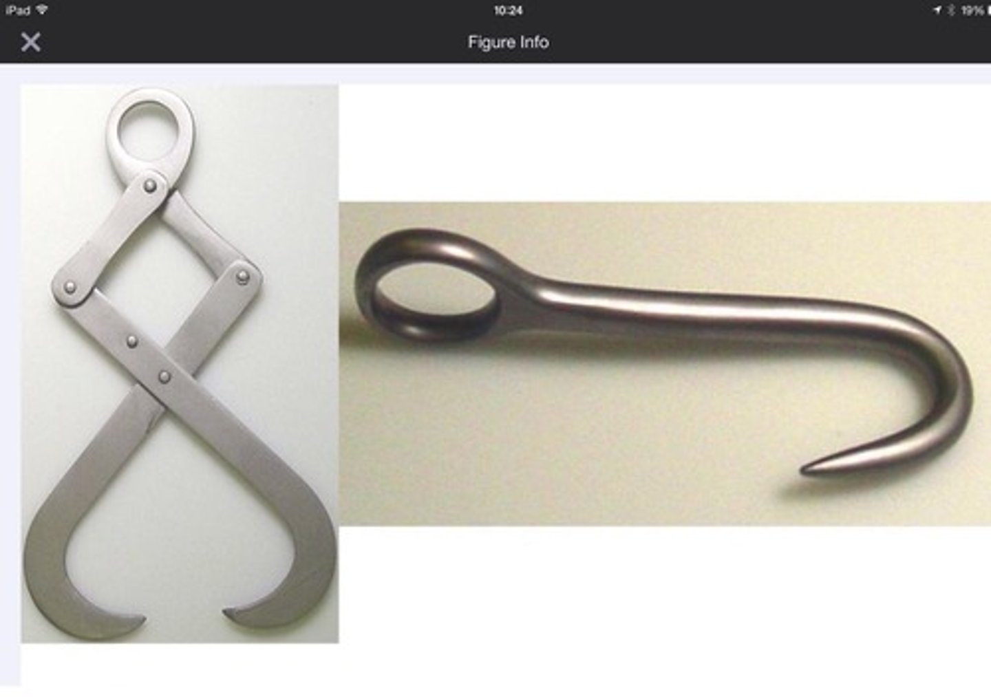 <p>To hold onto the fetus while performing an embryotomy.</p>