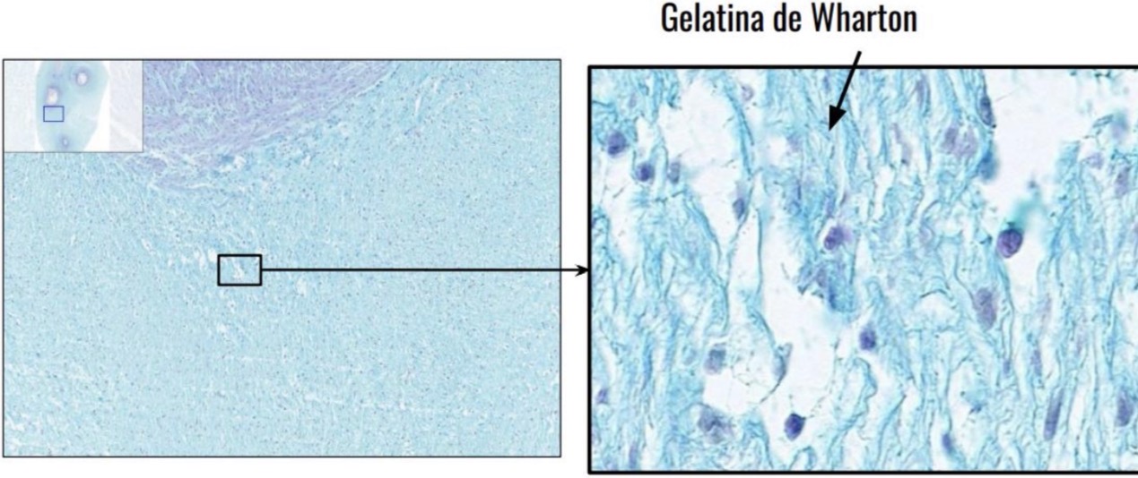 <p>Sustancia intercelular amorfa tinción azul alciano</p>