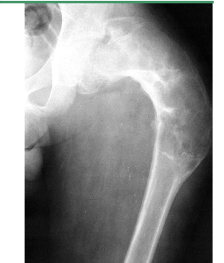 <p>What does this xray show?</p>