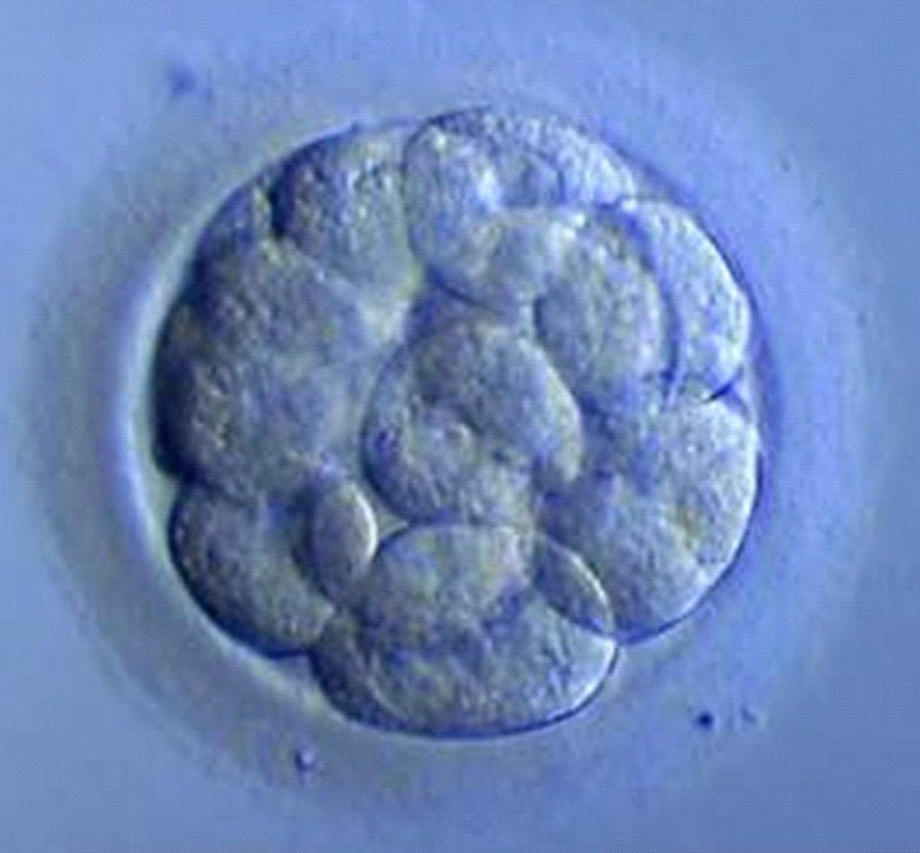 <p>a cluster of 16 cells that arrive in uterus, float free, and use uterine secretion for nutrition</p>
