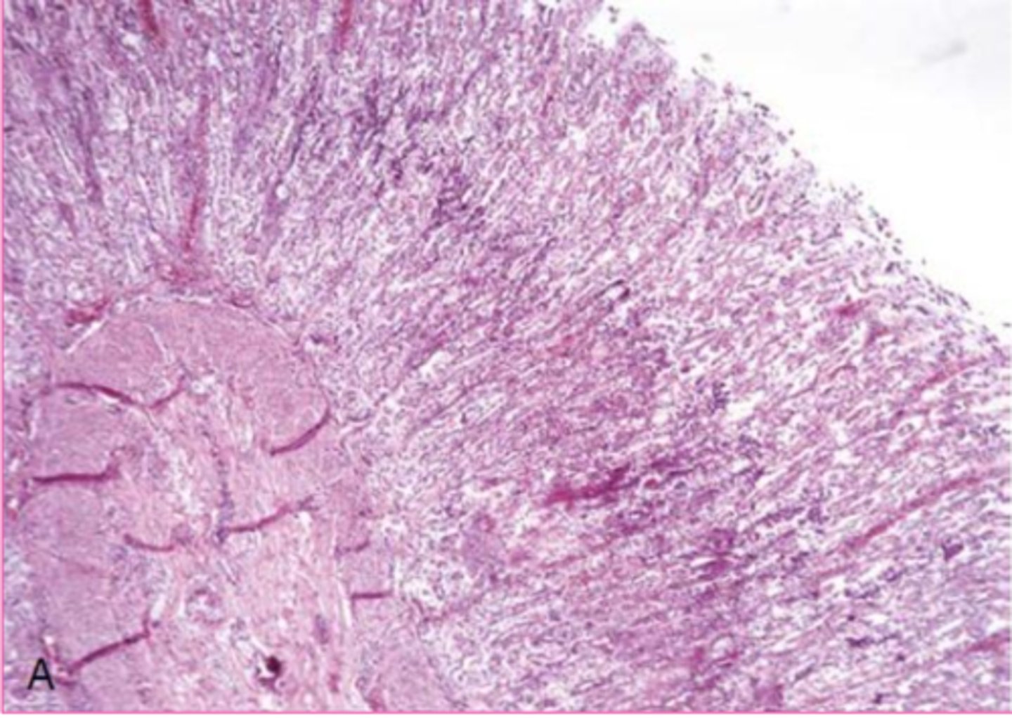 <p>Describe this extracellular inclusions?</p>