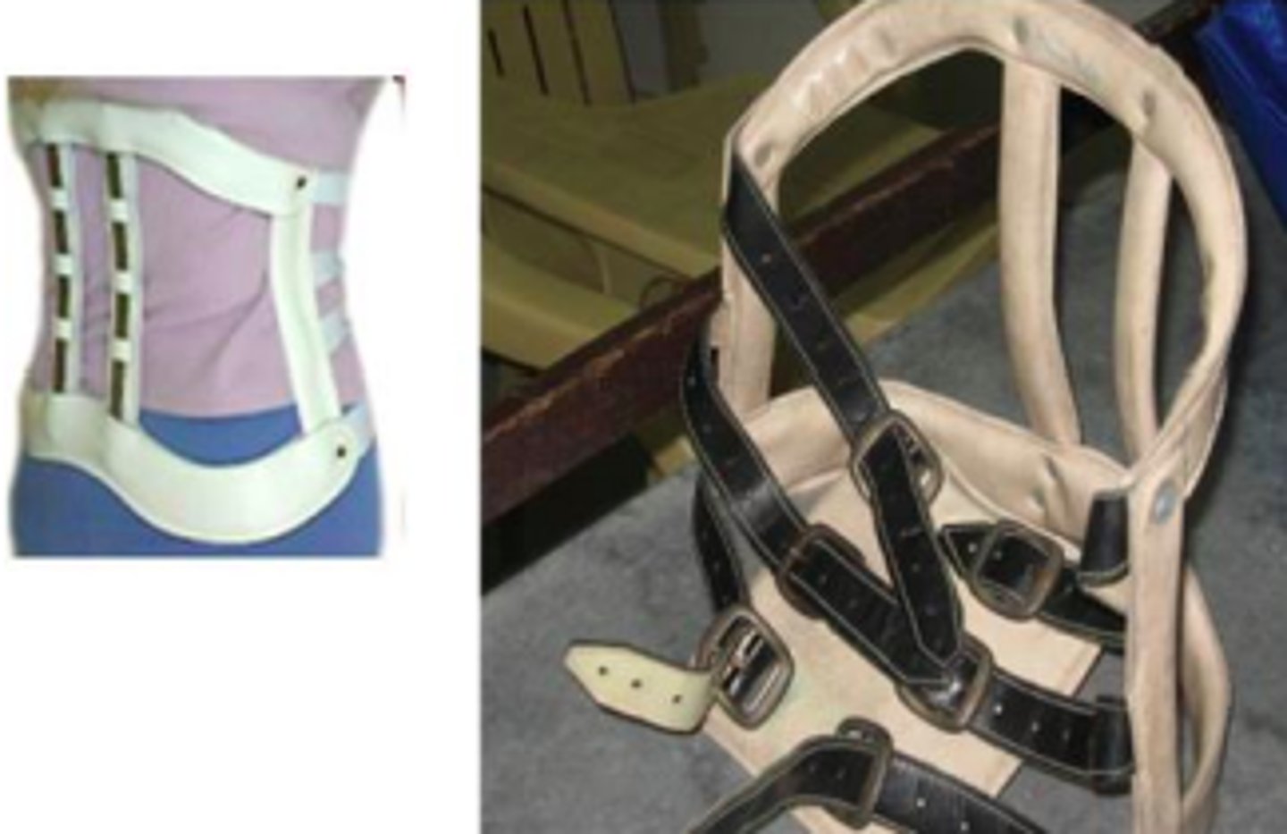<p>Lumbo-sacral spine and HNP</p>