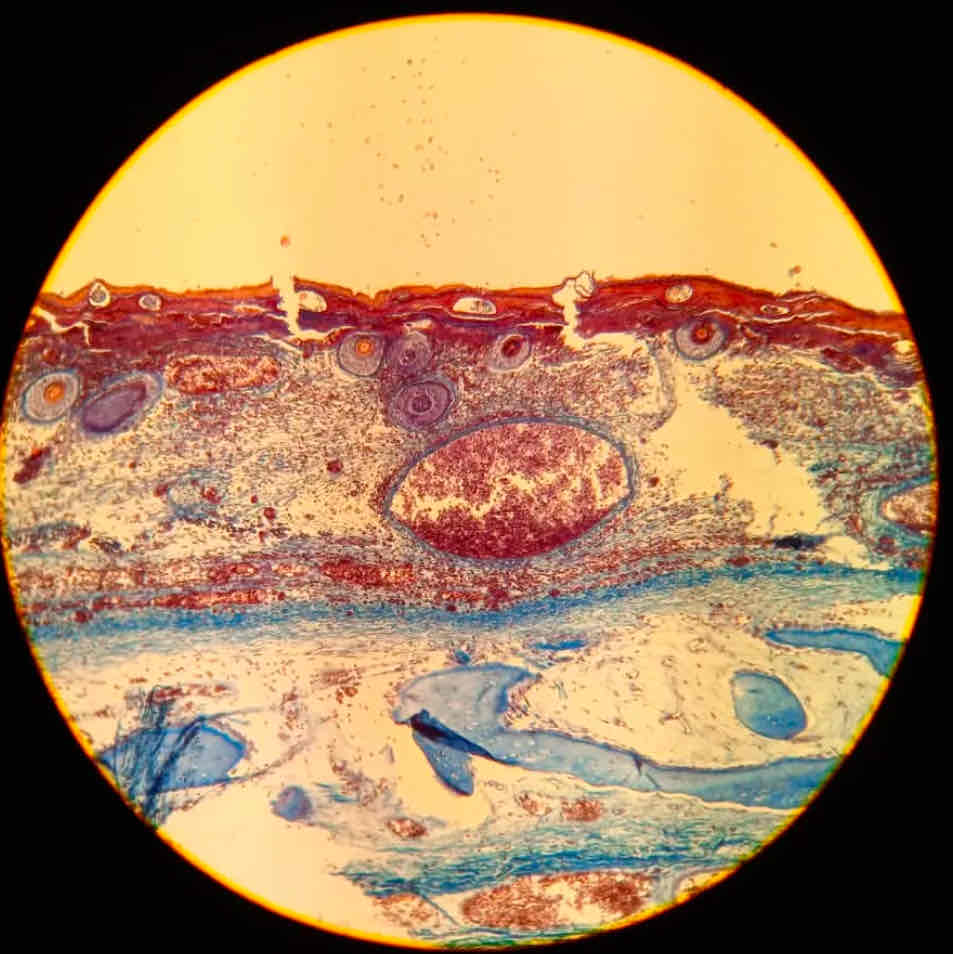 term image