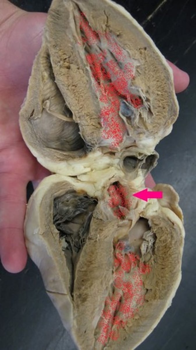 <p>Identify the valve.</p>