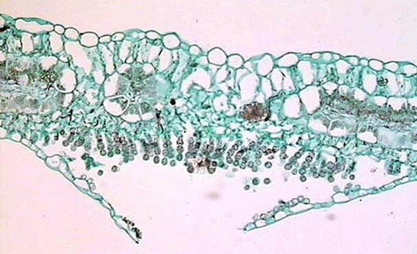 <p>Vitrost, Tvärsnitt genom blad; konidiebildning under epidermis (Oomycota)</p>