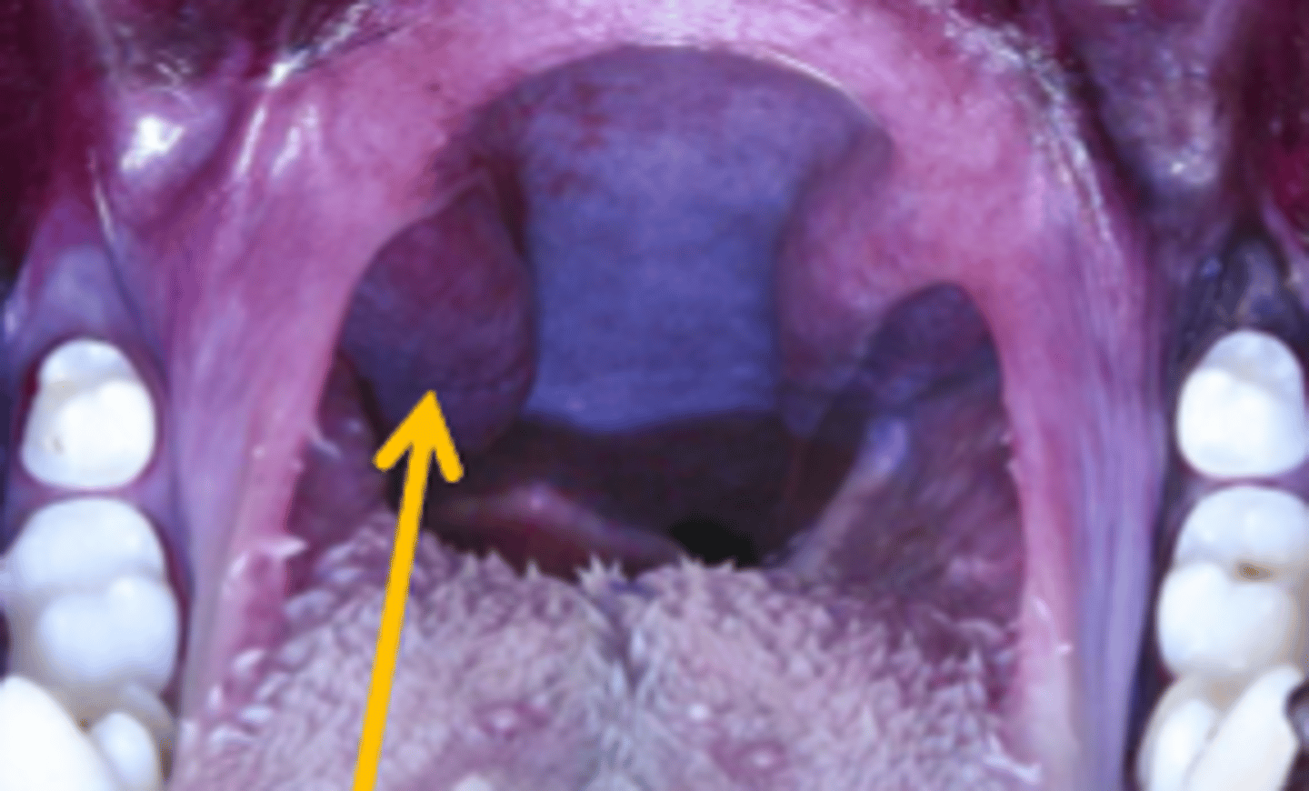 <p>lymphoid tissue of the pharynx</p>
