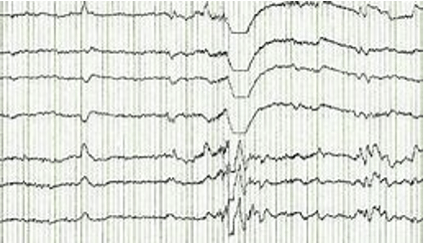 <p>electrical activity in the brain</p>