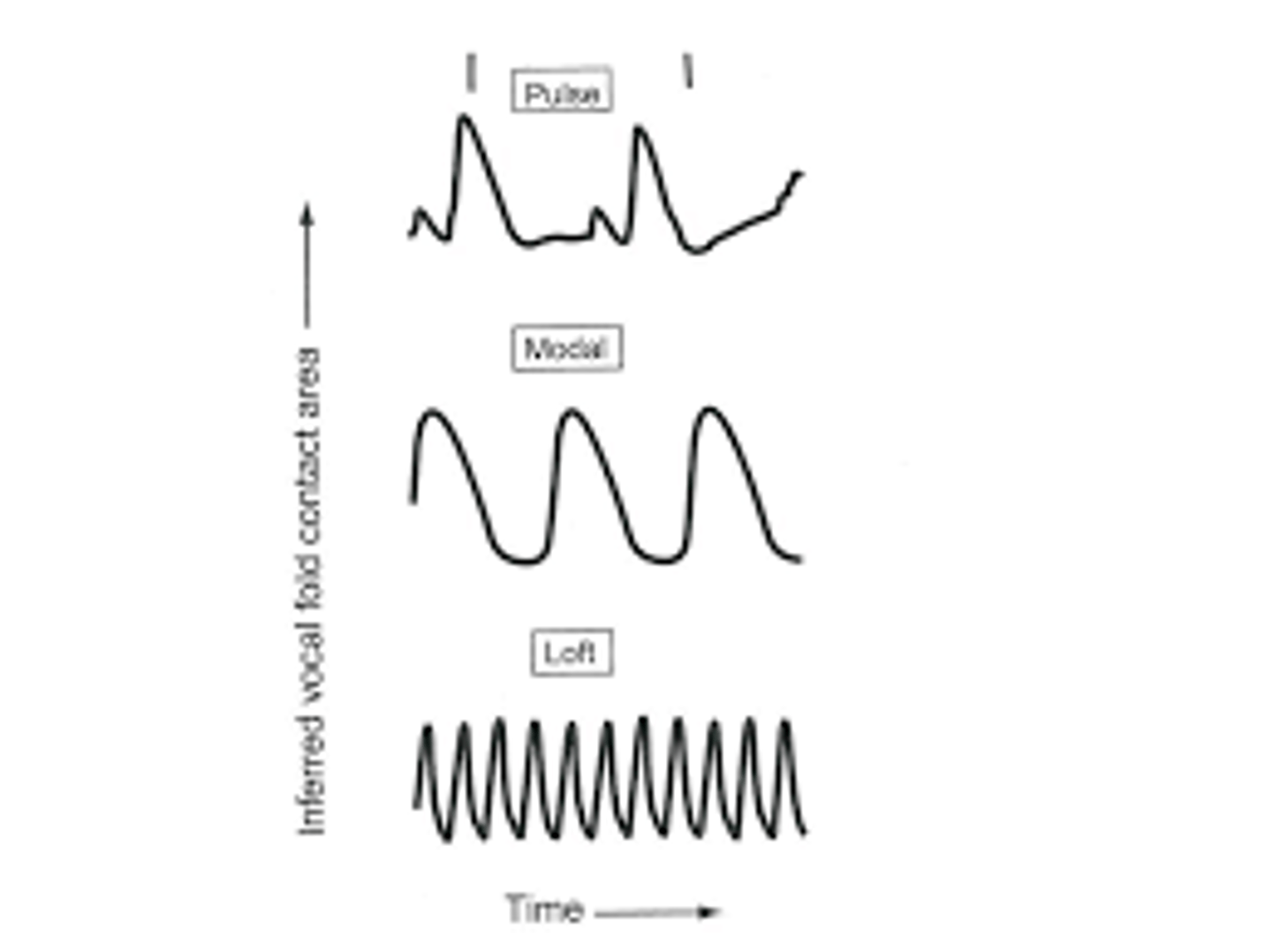 <p>rate of vocal fold vibration (Hz)</p>