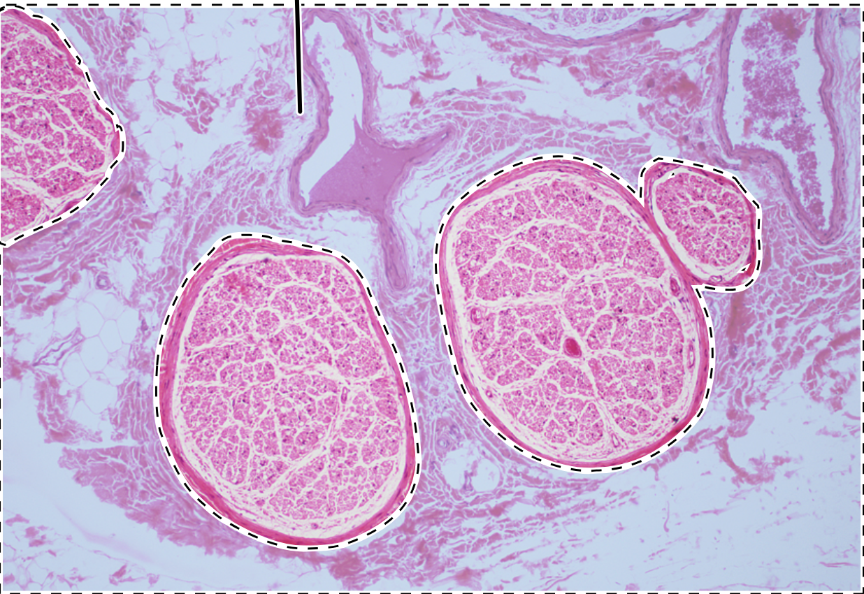 <p>Dense connective tissue that surrounds entire nerve including fascicles and blood vessels.</p>
