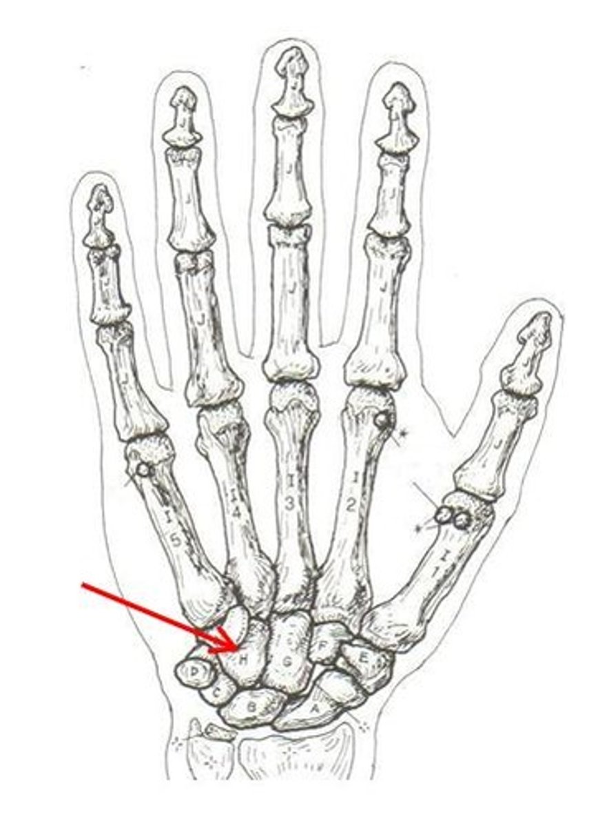 <p>ID bone</p>