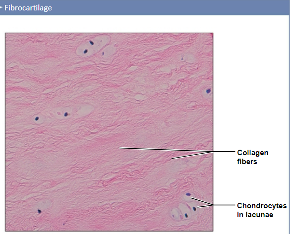 <p>Fibrocartilage — Location</p>