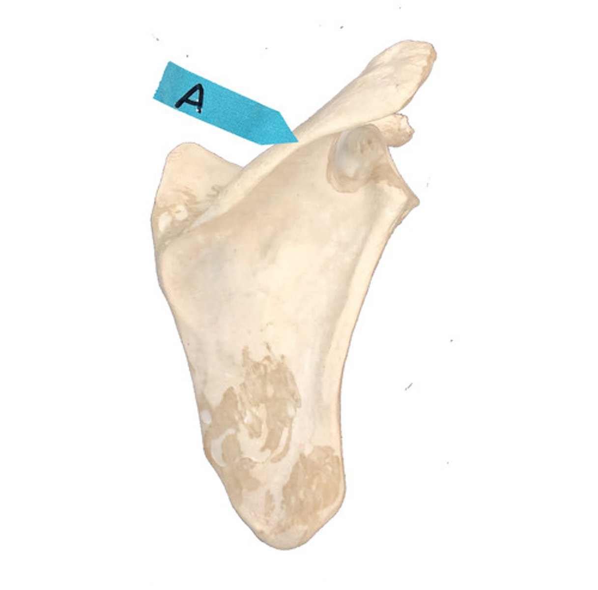 <p>Identify this bone marking.</p>
