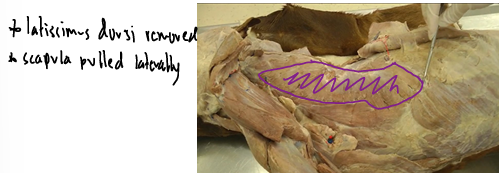 <p>Thoracic Limb (Forelimb) <span>Extrinsic Muscles (Attach limb to body)</span></p>