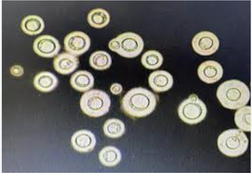 <p>Diagnosis for Cryptococcosis</p>