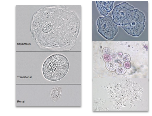 <ul><li><p class=""><strong>Line the genitourinary tract</strong></p></li><li><p class="">Three main types:</p><ul><li><p class=""><strong>Squamous</strong></p></li><li><p class=""><strong>Transitional</strong></p></li><li><p class=""><strong>Renal tubular</strong></p></li></ul></li></ul><p></p>