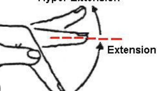 <p>Finger Extension</p>