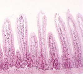 <p>tiny finger like projections that increase the surface area of the intestines.</p><p>MICROVILLI - each villi is in turn covered with many fine brush like microvilli that further increase the surface area</p><p></p>