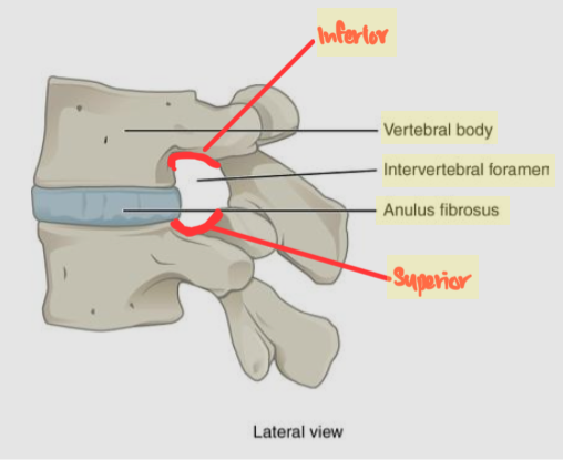 <p>Spinal cord passes through.</p><p>A. Inferior intervertebral notch</p><p>B. Vertebral body</p><p>C. Intervertebral foramen</p><p>D: Anulus fibrosis of Intervertebral disc</p><p>E: Superior intervertebral notch</p>