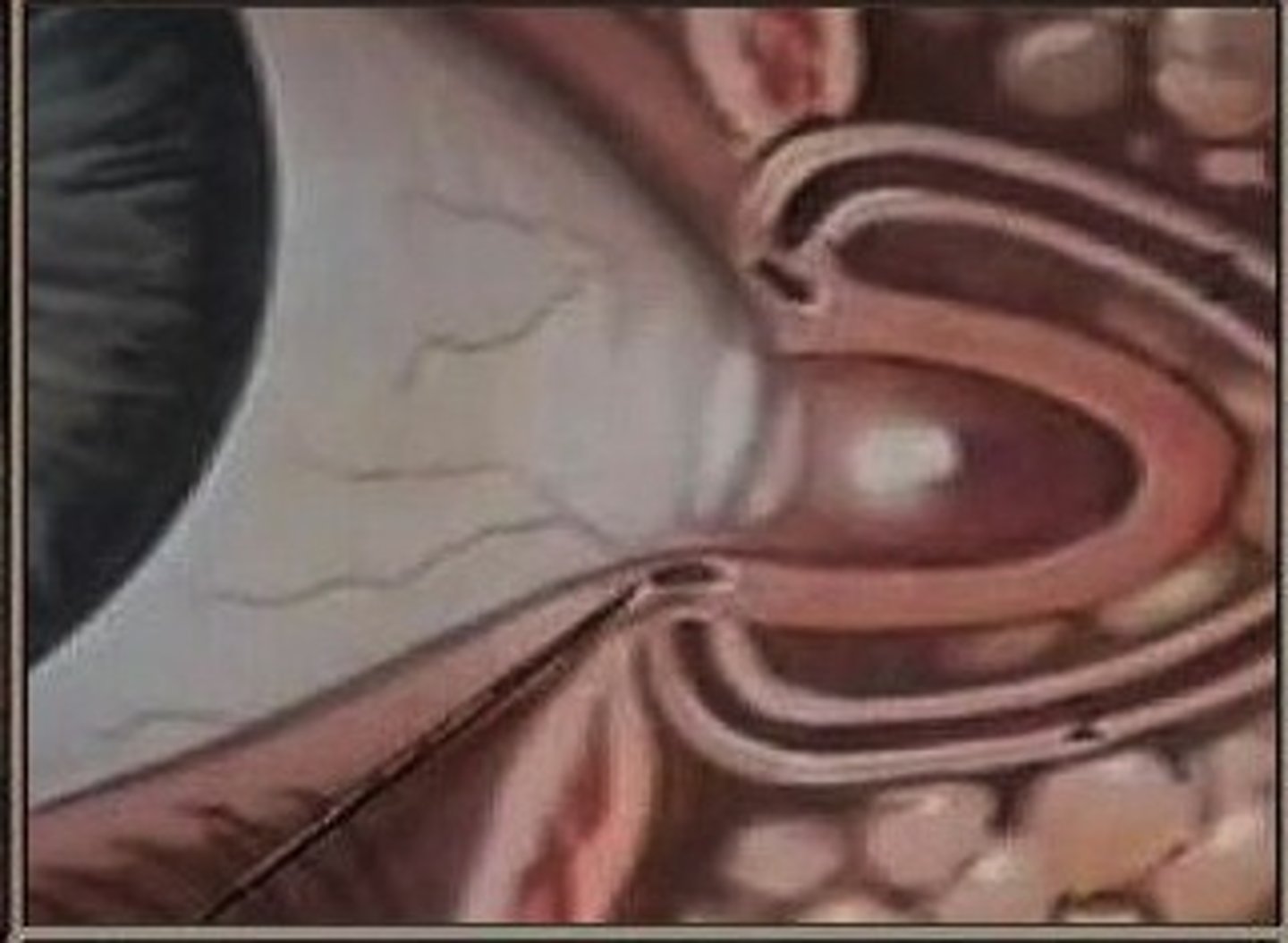 <p>two small holes in the medial canthus</p>