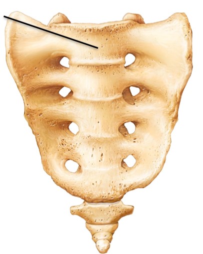 <p>What kind of vertebrae is the arrow pointing to?</p>