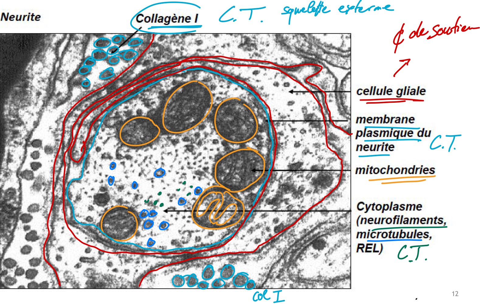 <p>ME</p><p>Neurites avec les cellules de soutiens autour. </p><ul><li><p>mitochondrie </p></li><li><p>Membrane cytoplasmique du neurite </p></li><li><p>Collagène de type 1 </p></li><li><p>Cytoplasme avec neurofilament, microtubule et REL</p></li></ul>