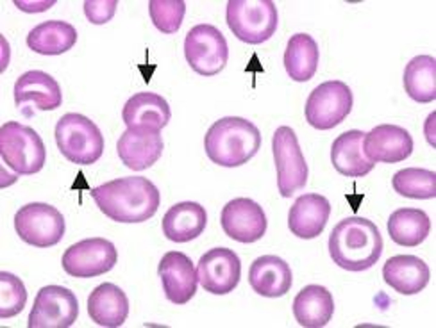 <p>variation in size</p><p>- compare to lymphocyte</p>