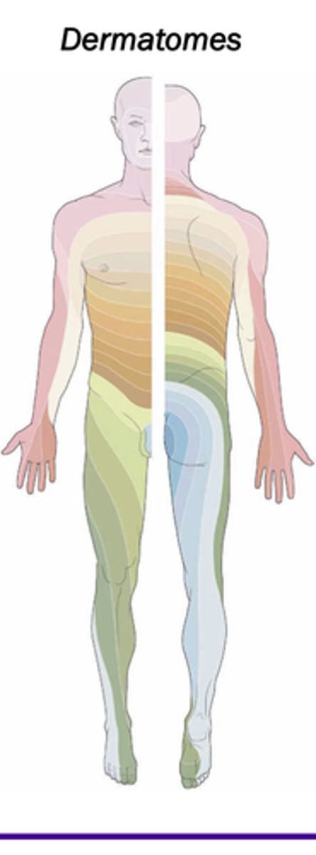 <p>One strop of skin innervated by one spinal nerve</p>