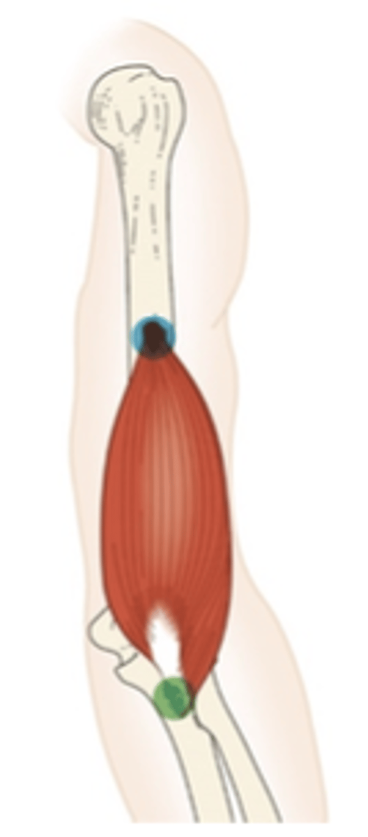 <p>What muscle is this?</p>