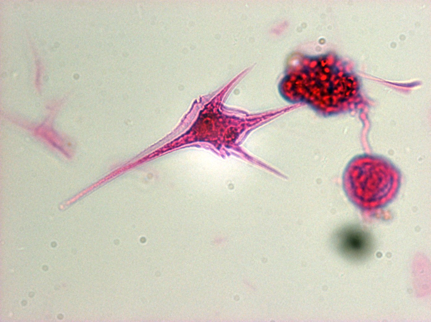 <p><span>Dinoflagellates</span></p>