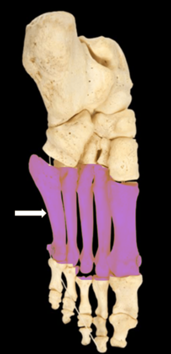 <p>name the bone</p>