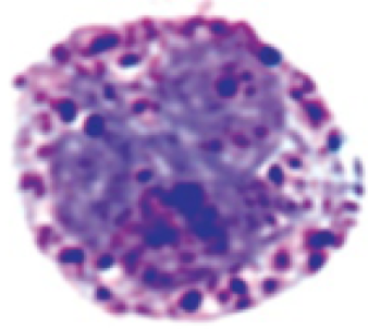 basophil