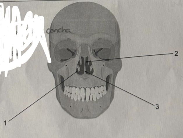 <p>what bone is labeled by #1</p>